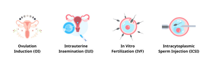 Infertility Treatment